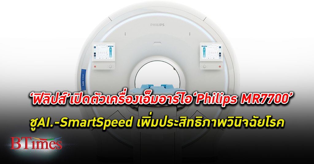 ฟิลิปส์ เปิดตัว Philips MR7700 เทคโนโลยีด้านการตรวจวินิจฉัยสุดล้ำ ชู AI - SmartSpeed